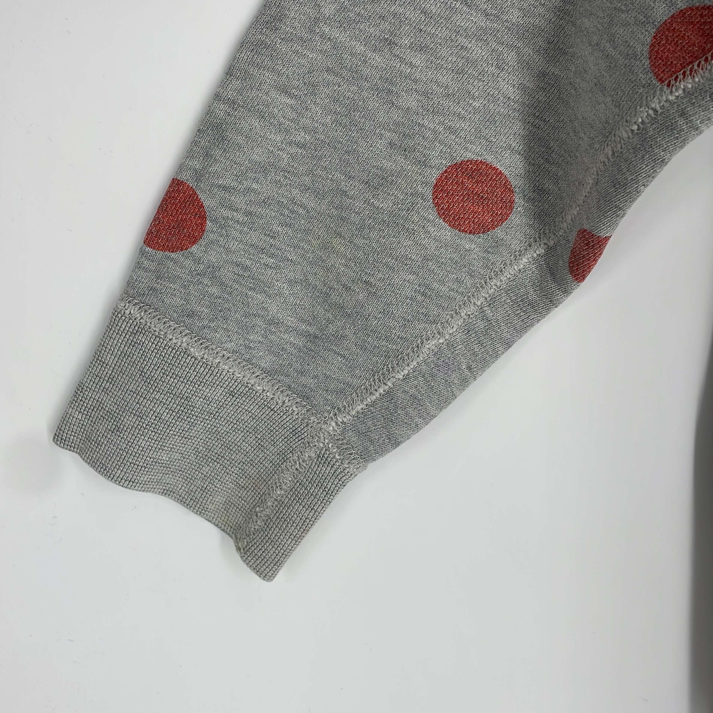 2-Sweat Acne 6 ans