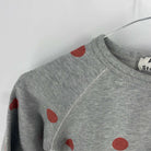 1-Sweat Acne 6 ans