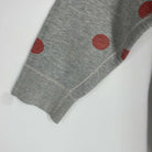 2-Sweat Acne 6 ans